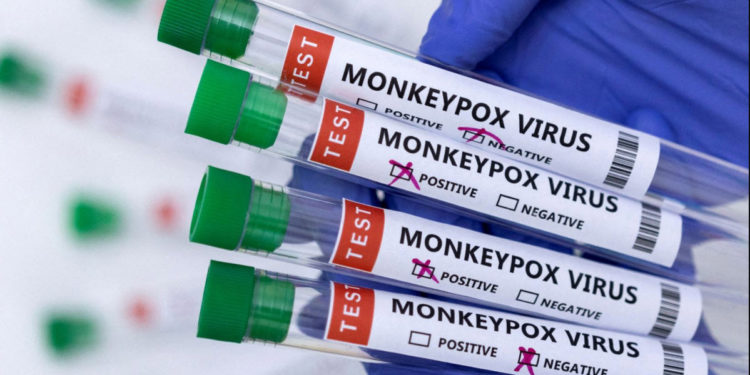 Власти США объявили чрезвычайную ситуацию в области здравоохранения из-за оспы обезьян