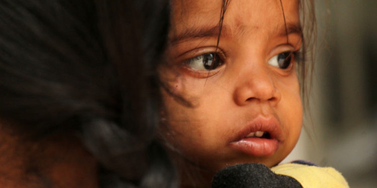 „Gripa tomatelor”. Care sunt simptomele noii boli foarte contagioase care apare la copii și se răspândește în India