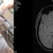 Un moment pentru viața Olgăi! Tânăra mamă a trei copii suferă de o boală grea și are nevoie de ajutorul nostru
