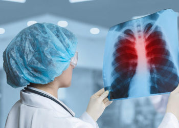 В прошлом году в Молдове туберкулезом заразились почти 2 000 человек