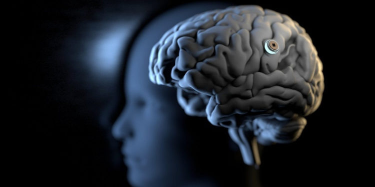 Elon Musk a anunțat că, până la sfârşitul anului, vrea să implanteze primul cip în creierul unui om