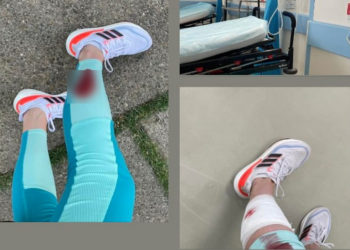 Собака покусала девушку в парке на Буюканах: «Что еще должно произойти?»