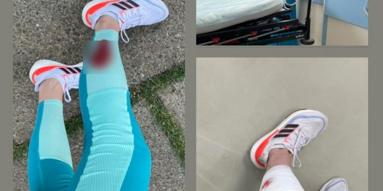 Собака покусала девушку в парке на Буюканах: «Что еще должно произойти?»