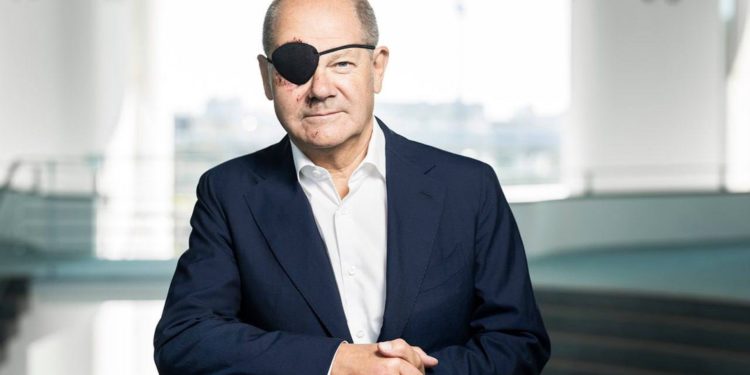 Шольц опубликовал первое фото после травмы, полученной во время занятий спортом