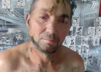 Căușeni: Un bărbat a fost desfigurat de o haită câini | VIDEO