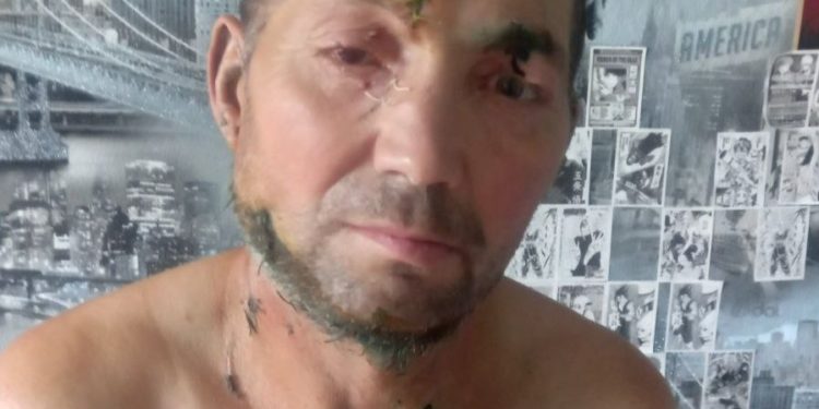 Căușeni: Un bărbat a fost desfigurat de o haită câini | VIDEO