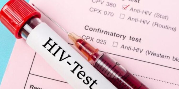 Date sumbre: Peste 16 mii de moldoveni suferă de HIV
