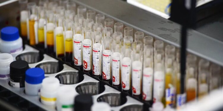 В США выявили рекордное с послевоенного периода число случаев сифилиса