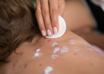 Un nou caz de rujeolă, înregistrat în R. Moldova