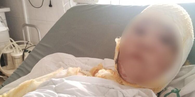 Caz șocant: O femeie și fiica ei de 7 ani, stropite cu acid de soț, au nevoie de ajutorul cetățenilor