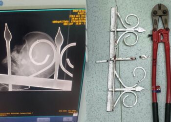 Fetiță de 5 ani, salvată de la moarte la IMC! A fost adusă pe patul de operație cu o bucată de gard înfiptă în gât