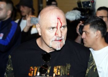 Отец Фьюри ударил представителя команды Усика