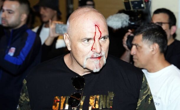 Отец Фьюри ударил представителя команды Усика