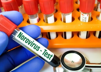 Virus periculos într-o destinaţie populară de vacanţă din Italia. Sute de oameni au ajuns la spital