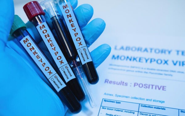 ВОЗ второй раз за два года объявила оспу обезьян «чрезвычайной ситуацией международного значения»