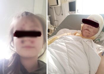 Жителя Кишинева, который облил жену и дочь кислотой, приговорили к 11 годам тюрьмы. Его также обязали выплатить компенсацию 1,6 млн леев