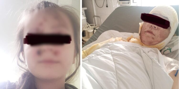 Жителя Кишинева, который облил жену и дочь кислотой, приговорили к 11 годам тюрьмы. Его также обязали выплатить компенсацию 1,6 млн леев