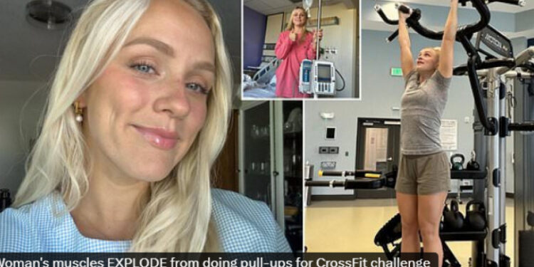Avertisment grav după ce mușchii unei femei au explodat în timpul exercițiilor de la sală. Afecțiunea care poate deveni mortală