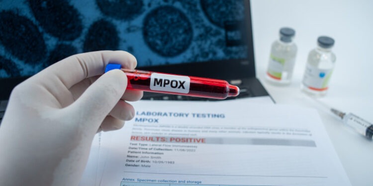 Noi cazuri de infecţie cu varianta mai periculoasă de mpox. Care sunt ţările care au confirmat îmbolnăviri