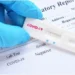 52 de cazuri de COVID-19 înregistrate în ultima săptămână, dintre care 16 sunt copii