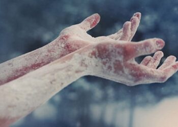 Mai multe persoane au suferit hipotermii și degerături din cauza vremii extreme