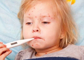 В 2024 году в Молдове зарегистрировали 210 случаев кори