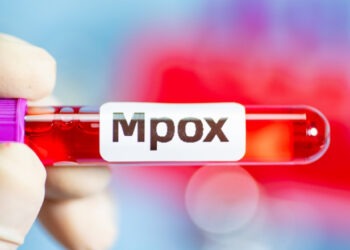 Primul caz de îmbolnăvire cu noua variantă mpox detectat în Franța