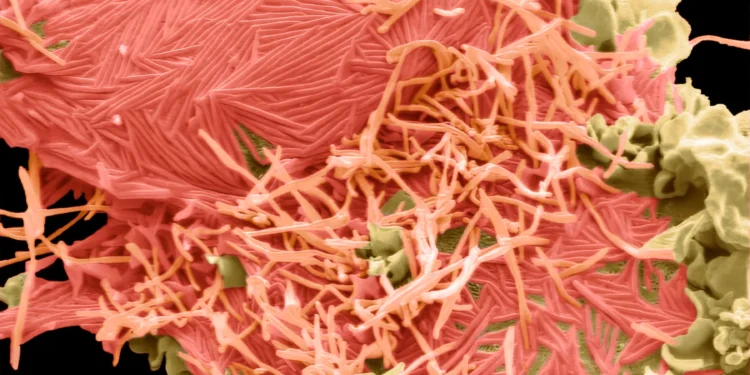 Creșterea cazurilor de infecție cu Metapneumovirusul uman (HMPV) în Moldova: Recomandările ANSP