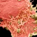 Creșterea cazurilor de infecție cu Metapneumovirusul uman (HMPV) în Moldova: Recomandările ANSP