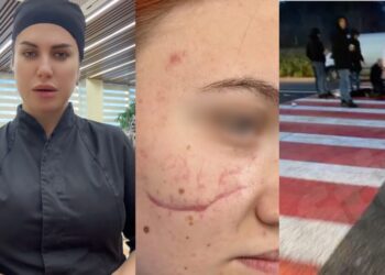 Adolescentă operată gratuit după un accident rutier în Orhei
