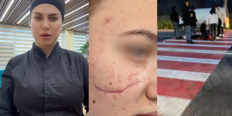 Adolescentă operată gratuit după un accident rutier în Orhei