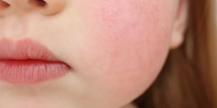 Învățătoare din Rîșcani acuzată de abuz fizic și verbal asupra unui elev autist