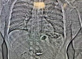 Hoț din Texas, acuzat că a înghițit cercei Tiffany de 769.000 de dolari după un jaf