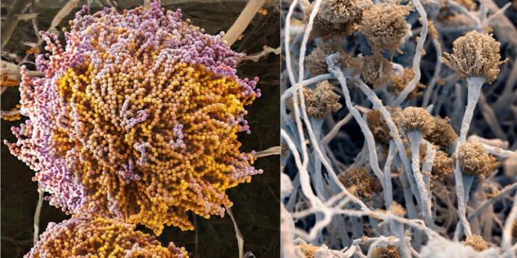 Un nou „supermicrob” ucigaș amenință planeta și se răspândește într-un ritm alarmant. De ce sunt infecțiile fungice atât de periculoase