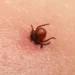 Creștere a cazurilor de boală Lyme și rujeolă în Chișinău