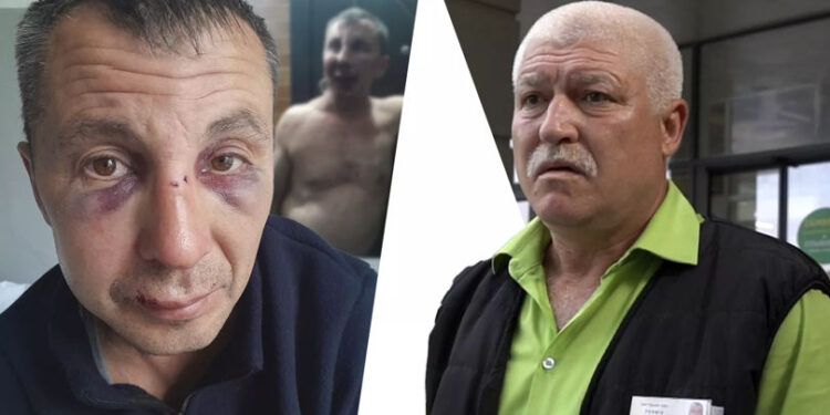 Bătaie între vecini la Sângerei: un fost polițist, acuzat de agresiune