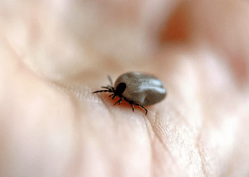 Mihai Craiu: Extracția greșită a unei căpușe poate favoriza infectarea copilului