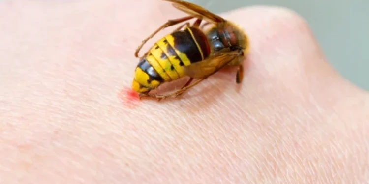 Peste 13.000 de apeluri la Urgență într-o săptămână. În creștere: șocuri anafilactice și arsuri