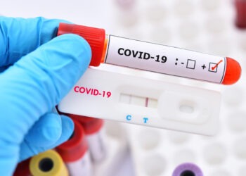 Cazurile de COVID-19 au scăzut cu 28%, dar ANSP recomandă vigilență