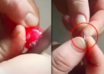 O mamă a găsit un obiect metalic într-o bomboană pentru copii