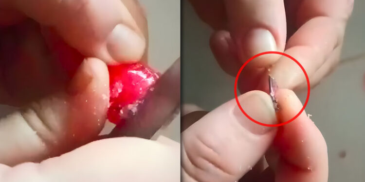 O mamă a găsit un obiect metalic într-o bomboană pentru copii