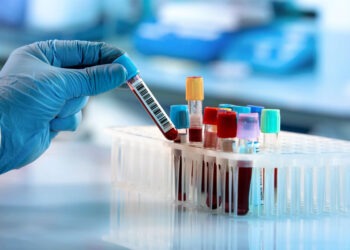 ВОЗ зафиксировала смертельный случай вируса Нипах в Бангладеш