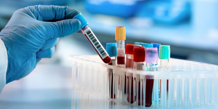 ВОЗ зафиксировала смертельный случай вируса Нипах в Бангладеш